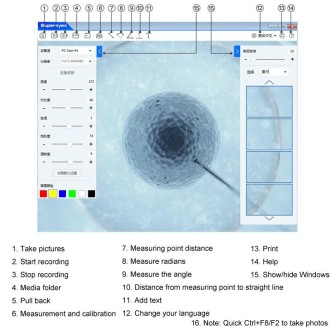 5 Million Digital Electron Microscope Magnifying Dermatoscope, Specification: B008+Z04 Universal Bracket+WIFI Box